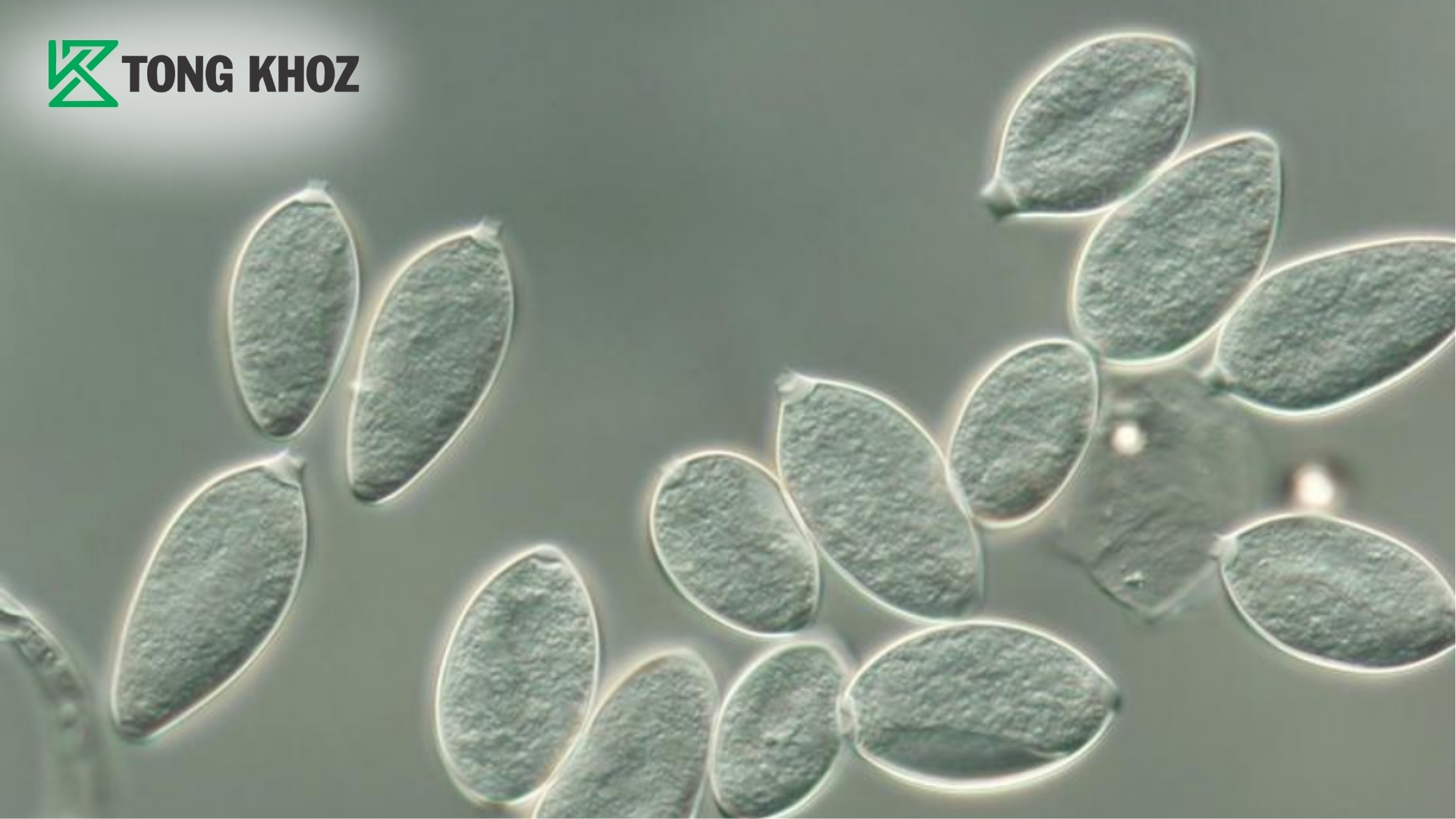 vi-sao-nam-phytophthora-nguy-hiem-tren-sau-rieng.jpg